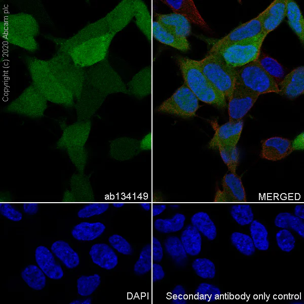 Immunocytochemistry/ Immunofluorescence - Anti-S100 alpha 6/PRA antibody [EPNCIR121] (AB134149)