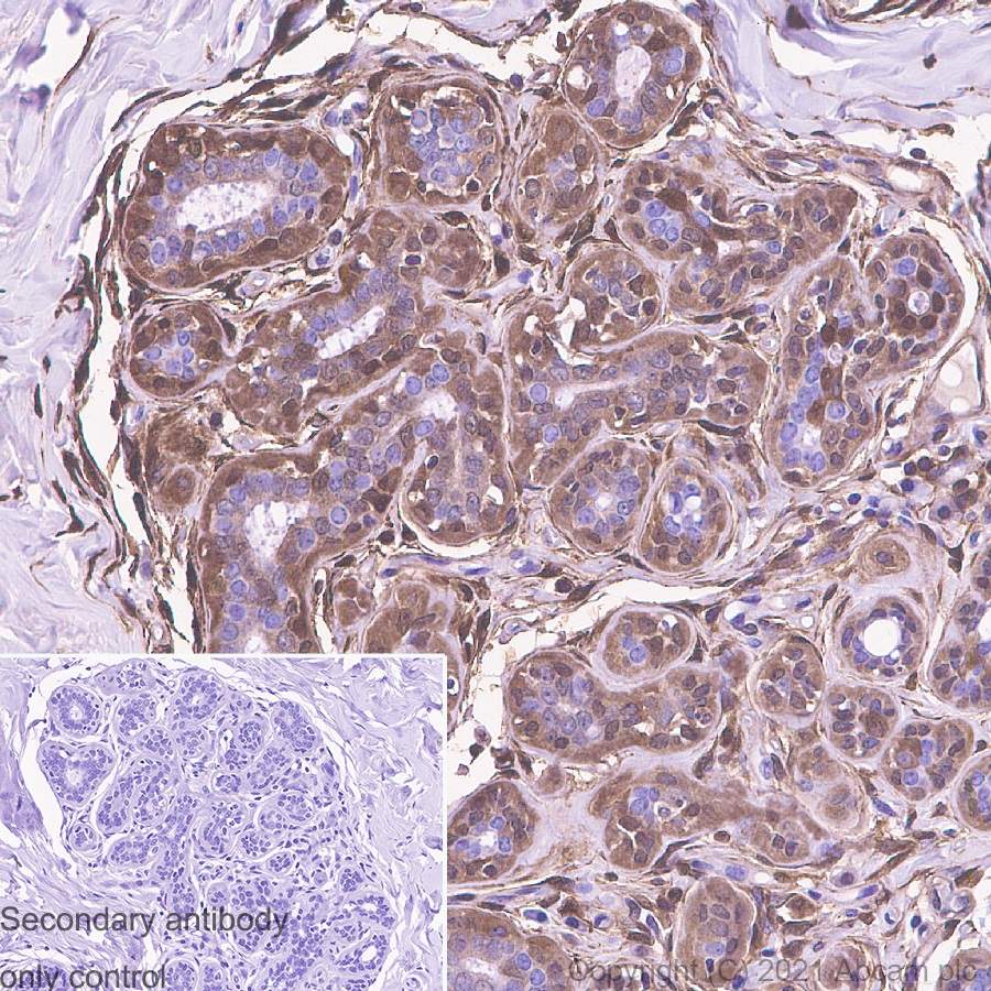 Immunohistochemistry (Formalin/PFA-fixed paraffin-embedded sections) - Anti-S100 alpha 6/PRA antibody [EPR13084-69] - BSA and Azide free (AB250543), expandable thumbnail