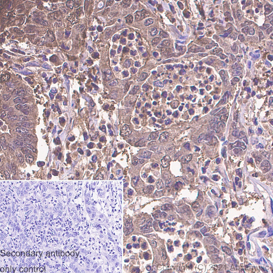 Immunohistochemistry (Formalin/PFA-fixed paraffin-embedded sections) - Anti-S100 alpha 6/PRA antibody [EPR13084-69] - BSA and Azide free (ab250543), expandable thumbnail