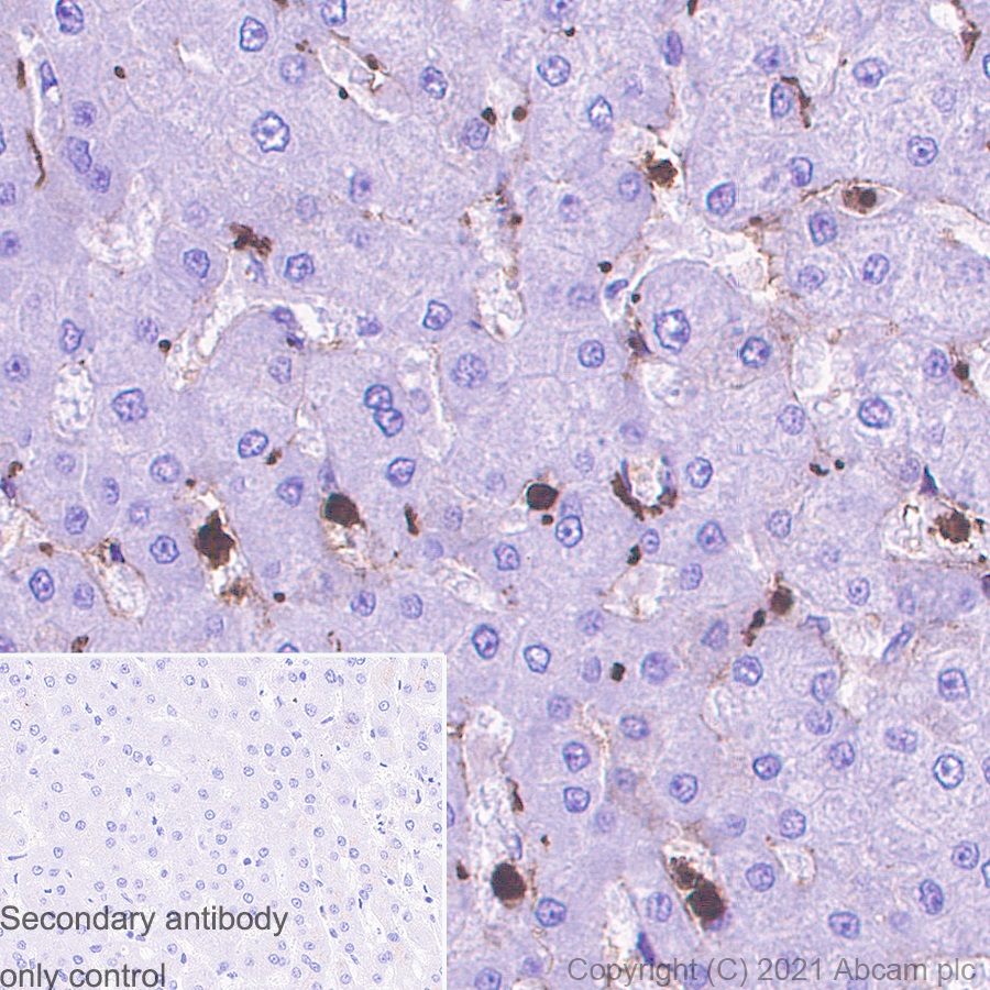 Immunohistochemistry (Formalin/PFA-fixed paraffin-embedded sections) - Anti-S100 alpha 6/PRA antibody [EPR13084-69] - BSA and Azide free (ab250543), expandable thumbnail