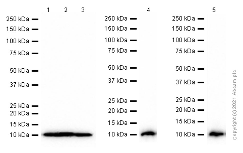 Western blot - Anti-S100 alpha 6/PRA antibody [EPR13084-69] - BSA and Azide free (AB250543), expandable thumbnail