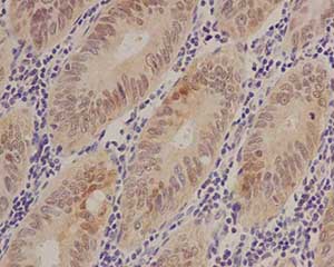 Immunohistochemistry (Formalin/PFA-fixed paraffin-embedded sections) - Anti-S100 alpha 6/PRA antibody [EPR13084] (AB181974)