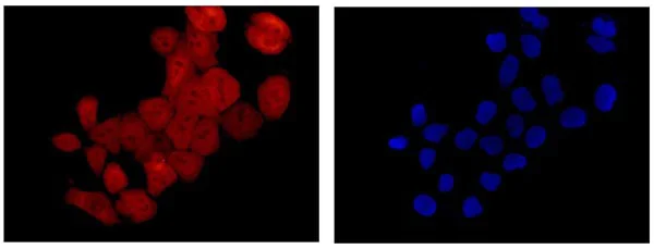 Immunocytochemistry/ Immunofluorescence - Anti-S100 alpha 6/PRA antibody [EPR13084] - BSA and Azide free (AB250542)