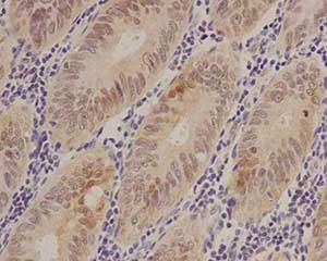 Immunohistochemistry (Formalin/PFA-fixed paraffin-embedded sections) - Anti-S100 alpha 6/PRA antibody [EPR13084] - BSA and Azide free (AB250542)