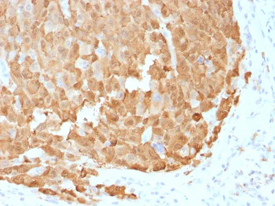 Immunohistochemistry (Formalin/PFA-fixed paraffin-embedded sections) - Anti-S100 alpha antibody [1942] - BSA and Azide free (AB212818)