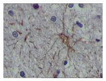 Immunohistochemistry (Formalin/PFA-fixed paraffin-embedded sections) - Anti-S100 alpha antibody [2C8B8] (AB52271)