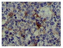 Immunohistochemistry (Formalin/PFA-fixed paraffin-embedded sections) - Anti-S100 alpha antibody [2C8B8] (AB52271)