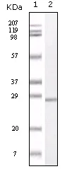 Western blot - Anti-S100 alpha antibody [2C8B8] (AB52271)