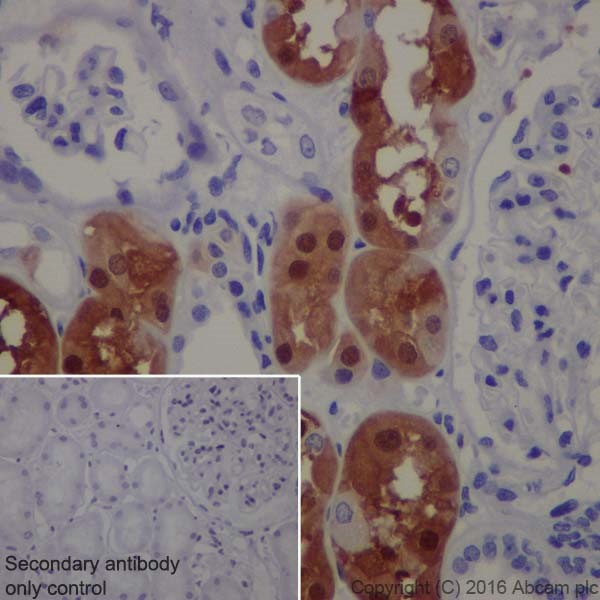 Immunohistochemistry (Formalin/PFA-fixed paraffin-embedded sections) - Anti-S100 alpha antibody [EPR19013] (AB183979), expandable thumbnail