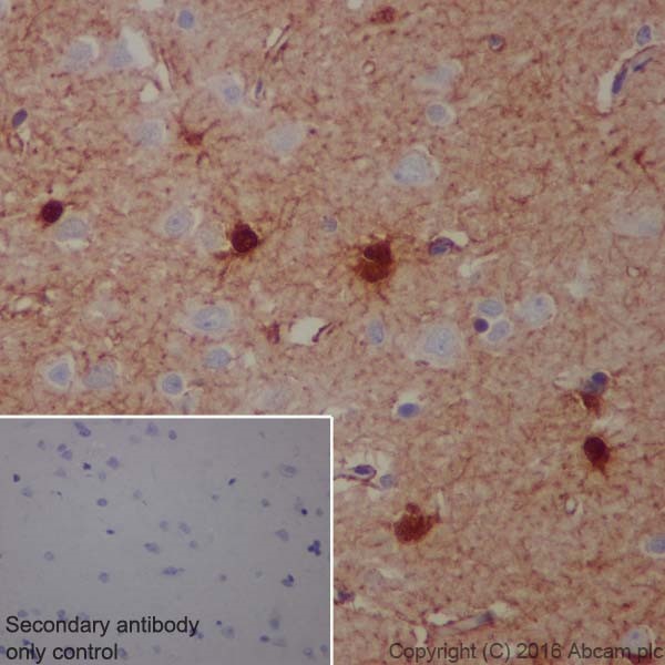 Immunohistochemistry (Formalin/PFA-fixed paraffin-embedded sections) - Anti-S100 alpha antibody [EPR19013] (AB183979), expandable thumbnail