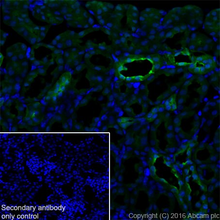 Immunohistochemistry (Frozen sections) - Anti-S100 alpha antibody [EPR19013] (ab183979), expandable thumbnail