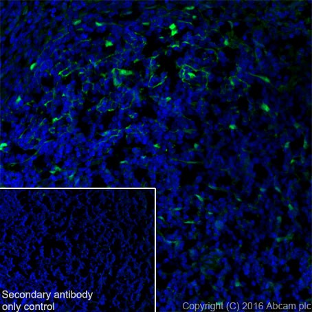 Immunohistochemistry (Frozen sections) - Anti-S100 alpha antibody [EPR19013] (ab183979), expandable thumbnail