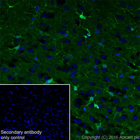 Immunohistochemistry (Frozen sections) - Anti-S100 alpha antibody [EPR19013] (AB183979), expandable thumbnail