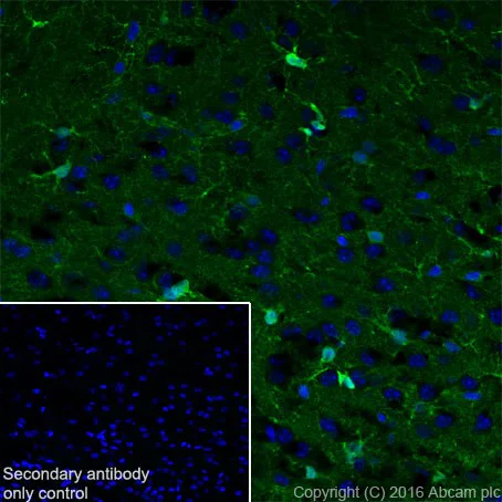 Immunohistochemistry (Frozen sections) - Anti-S100 alpha antibody [EPR19013] (AB183979)