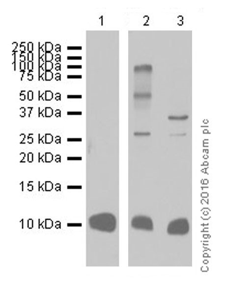 Western blot - Anti-S100 alpha antibody [EPR19013] (ab183979), expandable thumbnail