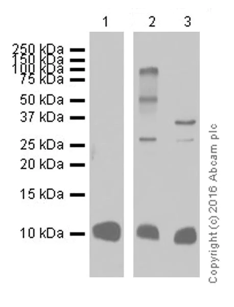 Western blot - Anti-S100 alpha antibody [EPR19013] (AB183979)