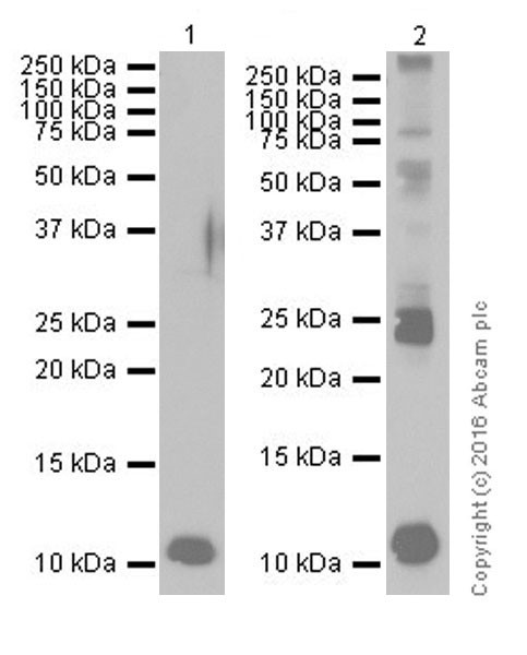 Western blot - Anti-S100 alpha antibody [EPR19013] (ab183979), expandable thumbnail