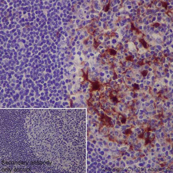 Immunohistochemistry (Formalin/PFA-fixed paraffin-embedded sections) - Anti-S100 alpha antibody [EPR19013] - BSA and Azide free (AB227580)