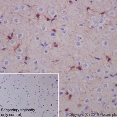 Immunohistochemistry (Formalin/PFA-fixed paraffin-embedded sections) - Anti-S100 alpha antibody [EPR5250] (AB133519)