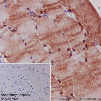 Immunohistochemistry (Formalin/PFA-fixed paraffin-embedded sections) - Anti-S100 alpha antibody [EPR5250] (AB133519)