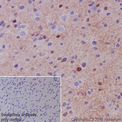 Immunohistochemistry (Formalin/PFA-fixed paraffin-embedded sections) - Anti-S100 alpha antibody [EPR5250] (AB133519)
