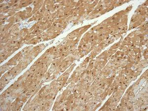 Immunohistochemistry (Formalin/PFA-fixed paraffin-embedded sections) - Anti-S100 alpha antibody [EPR5250] - BSA and Azide free (AB248534)