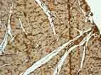 Immunohistochemistry (Formalin/PFA-fixed paraffin-embedded sections) - Anti-S100 alpha antibody [EPR5250] - BSA and Azide free (AB248534)