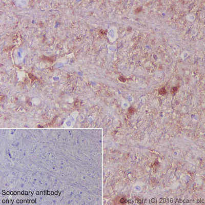 Immunohistochemistry (Formalin/PFA-fixed paraffin-embedded sections) - Anti-S100 alpha antibody [EPR5250] - BSA and Azide free (AB248534)