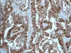 Immunohistochemistry (Formalin/PFA-fixed paraffin-embedded sections) - Anti-S100 alpha antibody [EPR5250] - BSA and Azide free (AB248534)