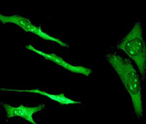 Immunocytochemistry/ Immunofluorescence - Anti-S100 alpha antibody [EPR5251] (AB109384)