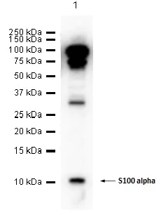 Western blot - Anti-S100 alpha antibody [EPR5251] (AB109384)