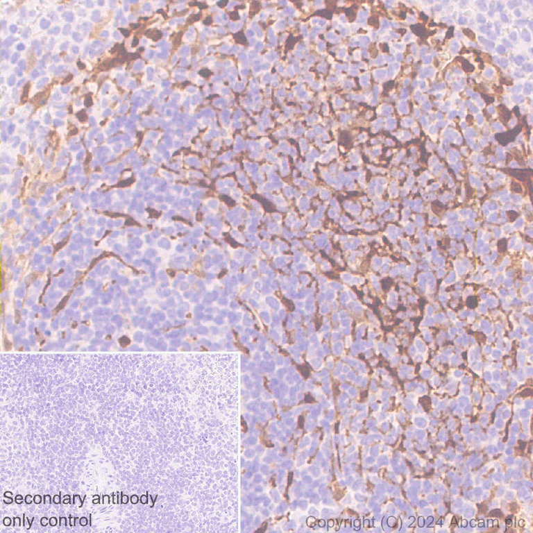 Immunohistochemistry (Formalin/PFA-fixed paraffin-embedded sections) - Anti-S100 alpha antibody [RM1154] (AB317634)