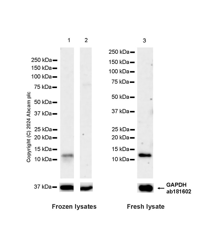 Western blot - Anti-S100 alpha antibody [RM1154] (AB317634)
