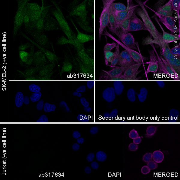 Immunocytochemistry/ Immunofluorescence - Anti-S100 alpha antibody [RM1154] - BSA and Azide free (ab317635), expandable thumbnail