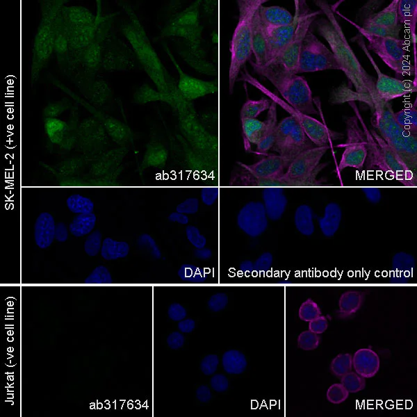 Immunocytochemistry/ Immunofluorescence - Anti-S100 alpha antibody [RM1154] - BSA and Azide free (AB317635)