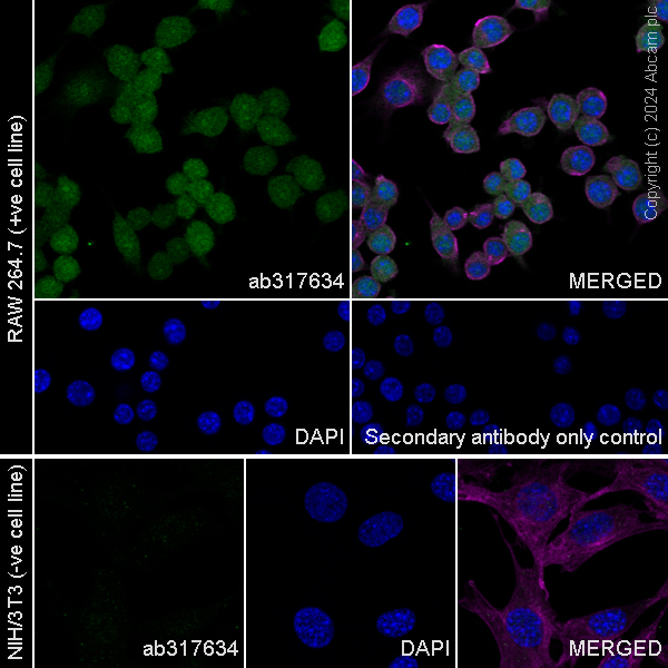 Immunocytochemistry/ Immunofluorescence - Anti-S100 alpha antibody [RM1154] - BSA and Azide free (ab317635), expandable thumbnail