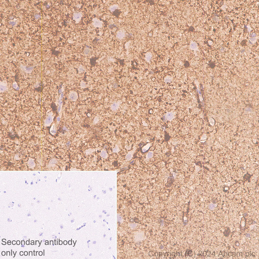 Immunohistochemistry (Formalin/PFA-fixed paraffin-embedded sections) - Anti-S100 alpha antibody [RM1154] - BSA and Azide free (ab317635), expandable thumbnail