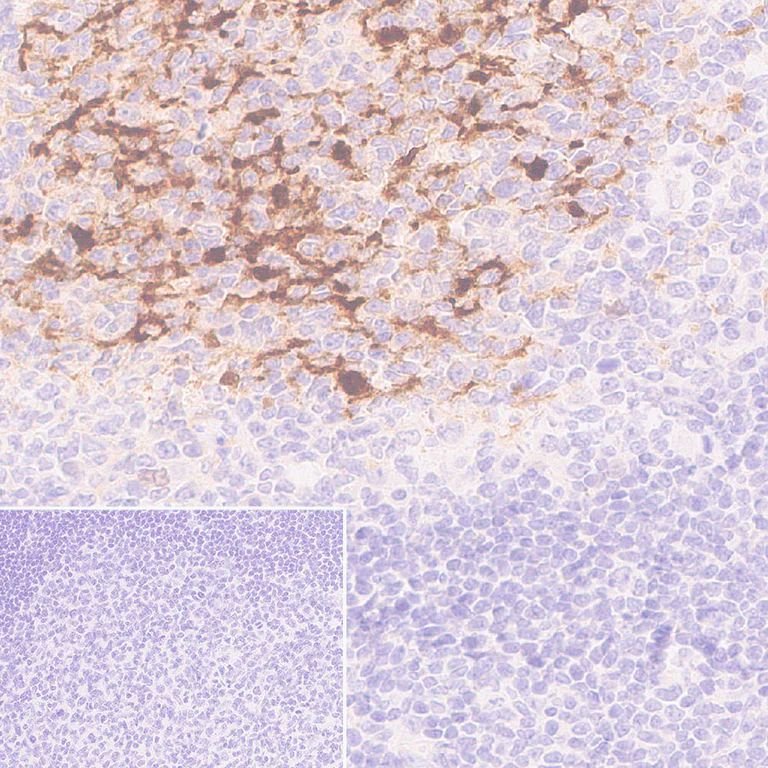 Immunohistochemistry (Formalin/PFA-fixed paraffin-embedded sections) - Anti-S100 alpha antibody [RM1154] - BSA and Azide free (AB317635)