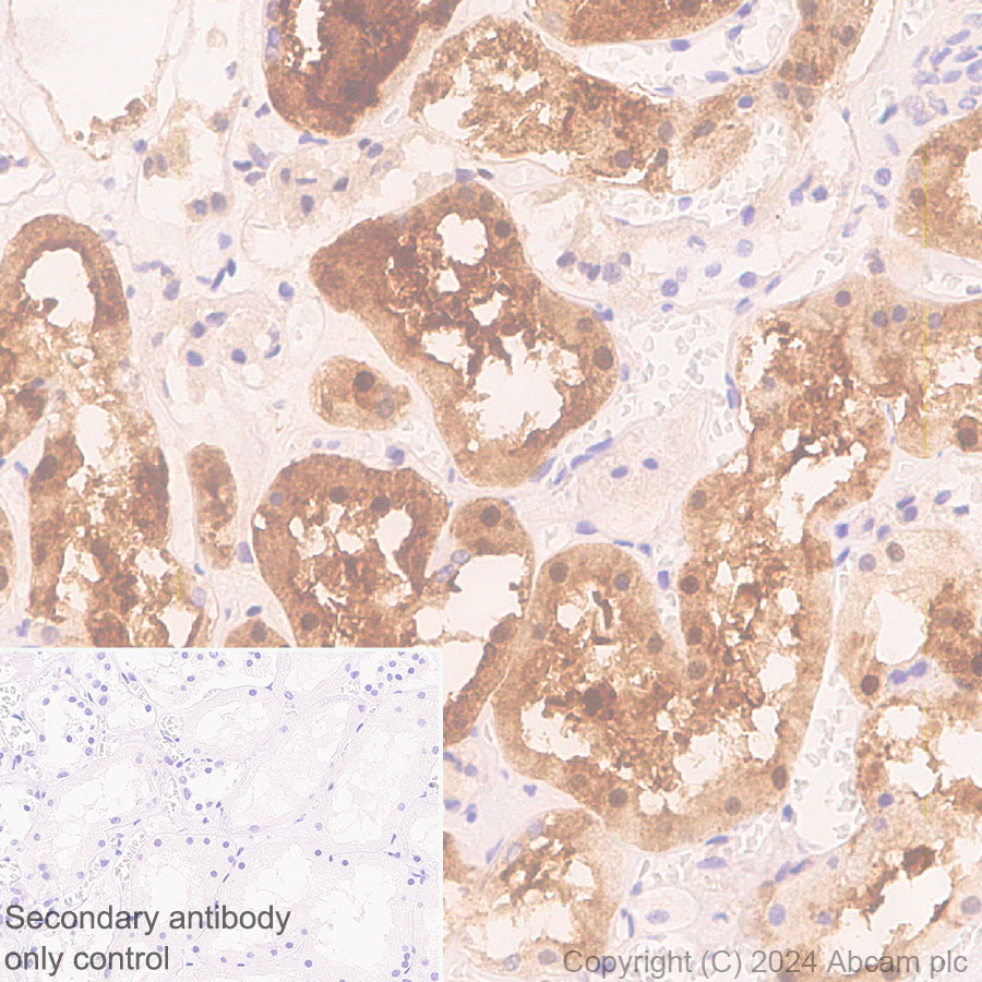 Immunohistochemistry (Formalin/PFA-fixed paraffin-embedded sections) - Anti-S100 alpha antibody [RM1154] - BSA and Azide free (ab317635), expandable thumbnail