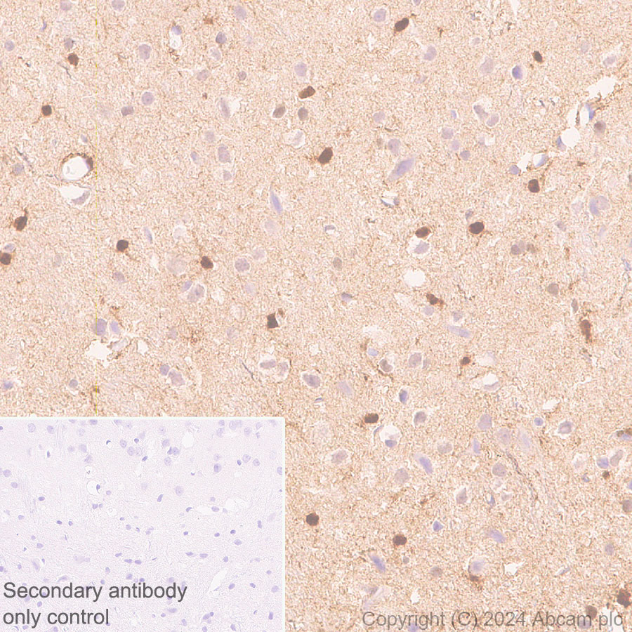 Immunohistochemistry (Formalin/PFA-fixed paraffin-embedded sections) - Anti-S100 alpha antibody [RM1154] - BSA and Azide free (AB317635), expandable thumbnail