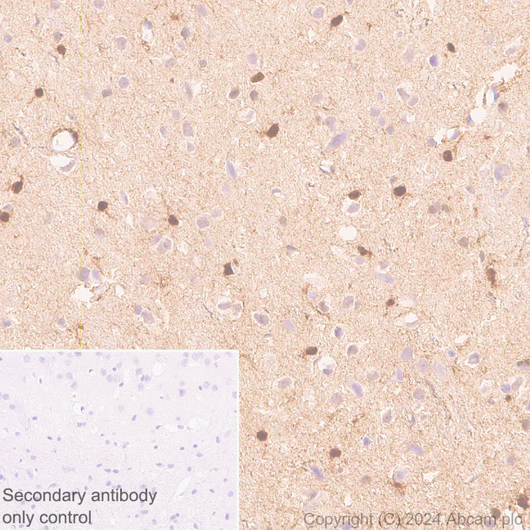 Immunohistochemistry (Formalin/PFA-fixed paraffin-embedded sections) - Anti-S100 alpha antibody [RM1154] - BSA and Azide free (AB317635)