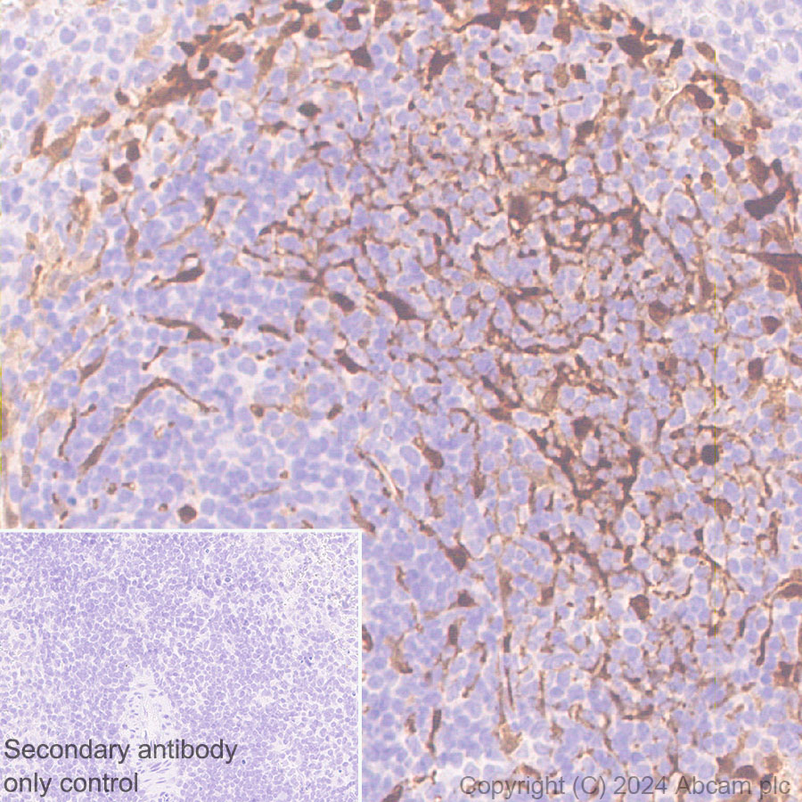 Immunohistochemistry (Formalin/PFA-fixed paraffin-embedded sections) - Anti-S100 alpha antibody [RM1154] - BSA and Azide free (AB317635), expandable thumbnail