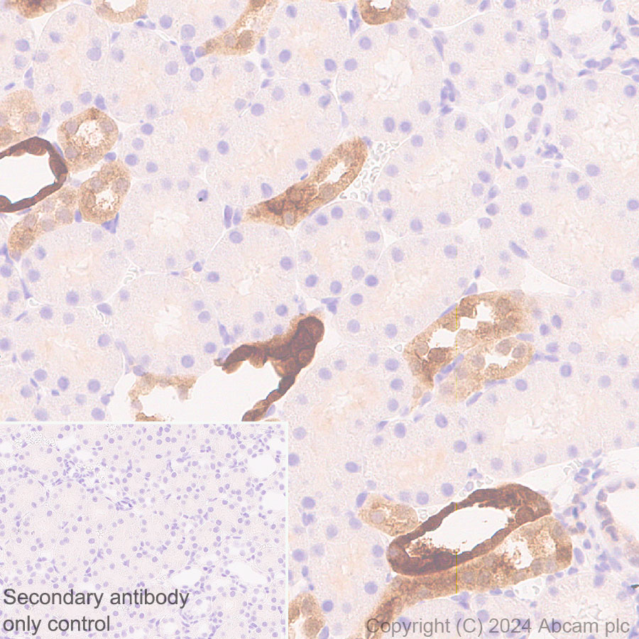 Immunohistochemistry (Formalin/PFA-fixed paraffin-embedded sections) - Anti-S100 alpha antibody [RM1154] - BSA and Azide free (AB317635), expandable thumbnail