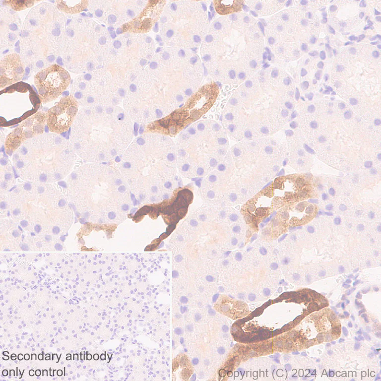 Immunohistochemistry (Formalin/PFA-fixed paraffin-embedded sections) - Anti-S100 alpha antibody [RM1154] - BSA and Azide free (AB317635)