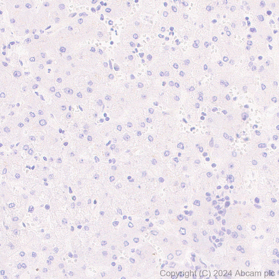 Immunohistochemistry (Formalin/PFA-fixed paraffin-embedded sections) - Anti-S100 alpha antibody [RM1154] - BSA and Azide free (AB317635), expandable thumbnail