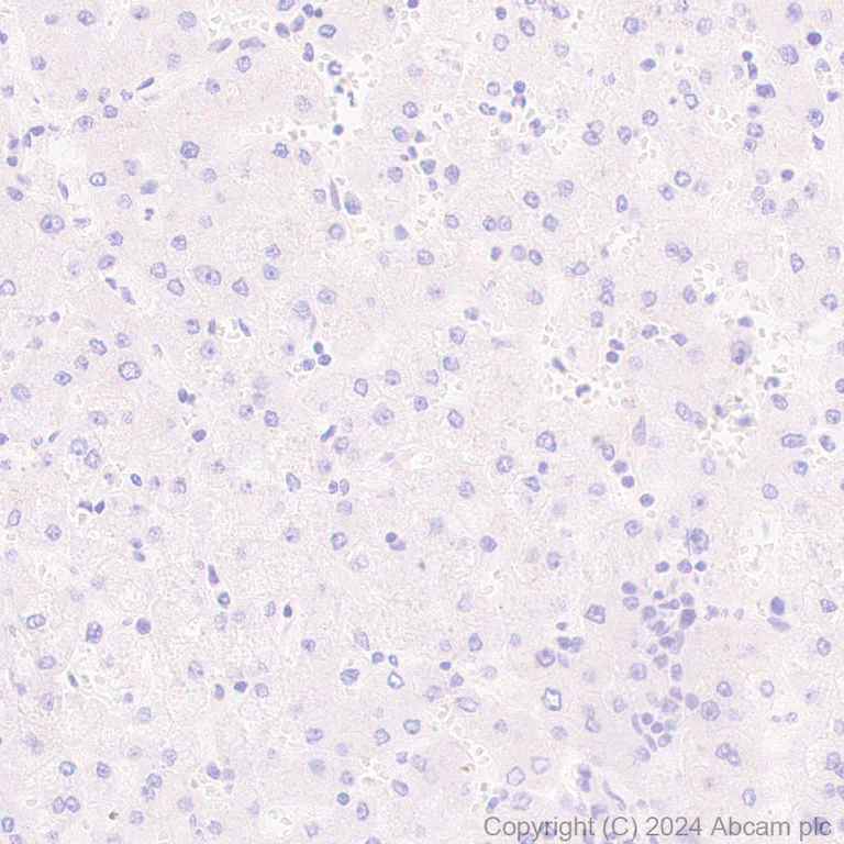 Immunohistochemistry (Formalin/PFA-fixed paraffin-embedded sections) - Anti-S100 alpha antibody [RM1154] - BSA and Azide free (AB317635)
