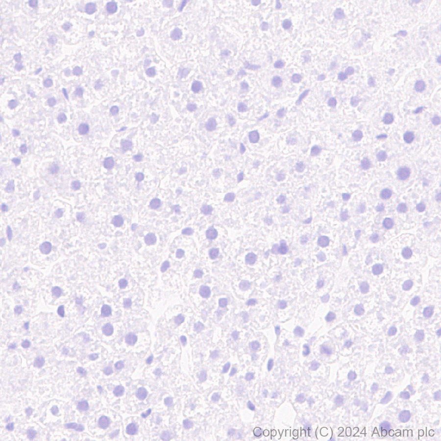 Immunohistochemistry (Formalin/PFA-fixed paraffin-embedded sections) - Anti-S100 alpha antibody [RM1154] - BSA and Azide free (AB317635), expandable thumbnail