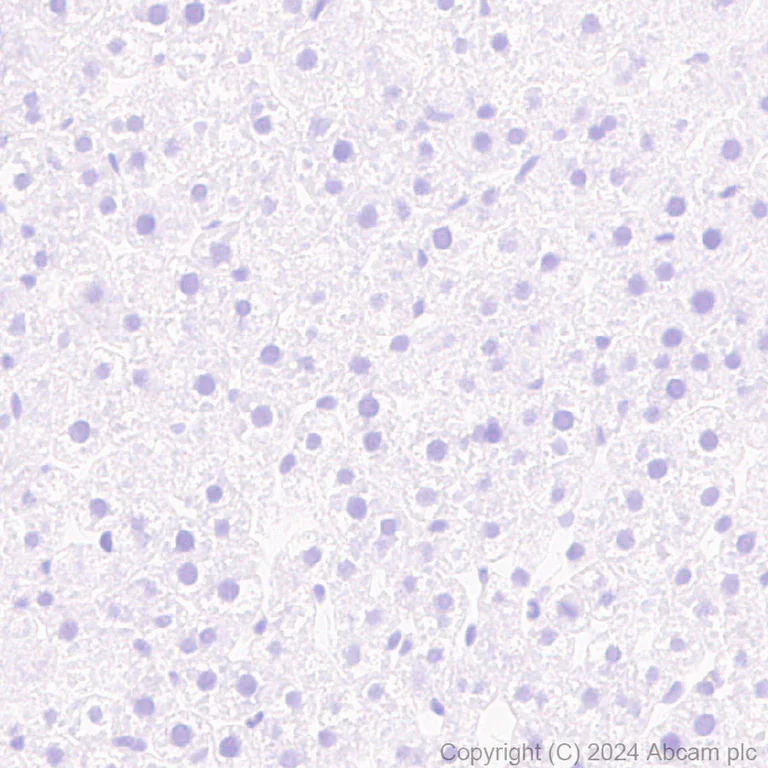 Immunohistochemistry (Formalin/PFA-fixed paraffin-embedded sections) - Anti-S100 alpha antibody [RM1154] - BSA and Azide free (AB317635)