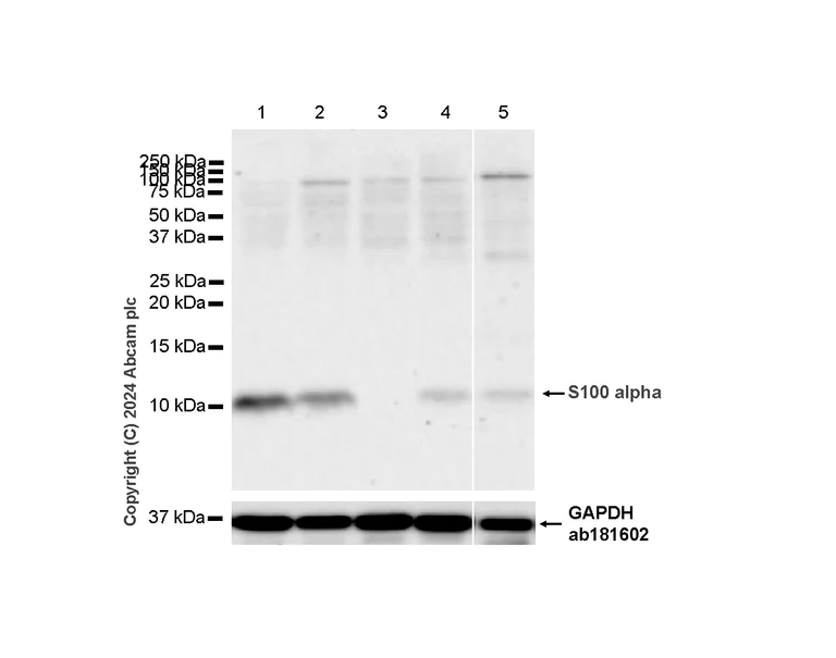 Western blot - Anti-S100 alpha antibody [RM1154] - BSA and Azide free (AB317635)