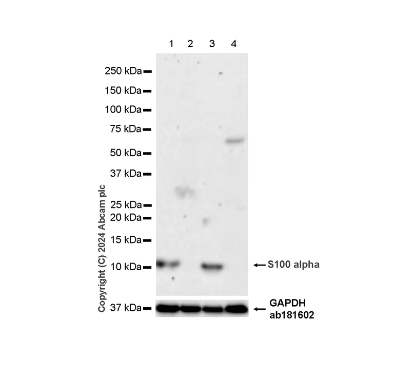Western blot - Anti-S100 alpha antibody [RM1154] - BSA and Azide free (AB317635)